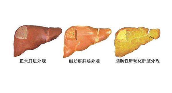 ֬���β��ܳ�ʲô ֬���λ��ߵ���ʳ����